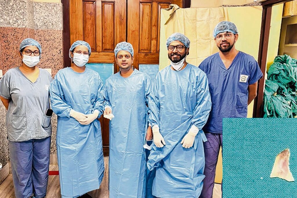 Child's life saved at SSKM Hospital after chicken bone stuck in throat