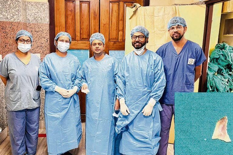 Child's life saved at SSKM Hospital after chicken bone stuck in throat